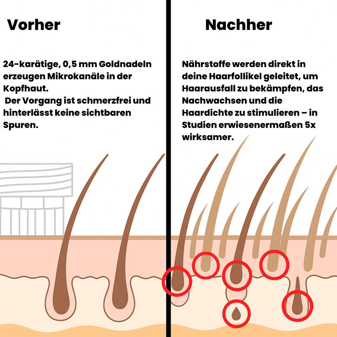 MannHair™ Haar Wachstum System